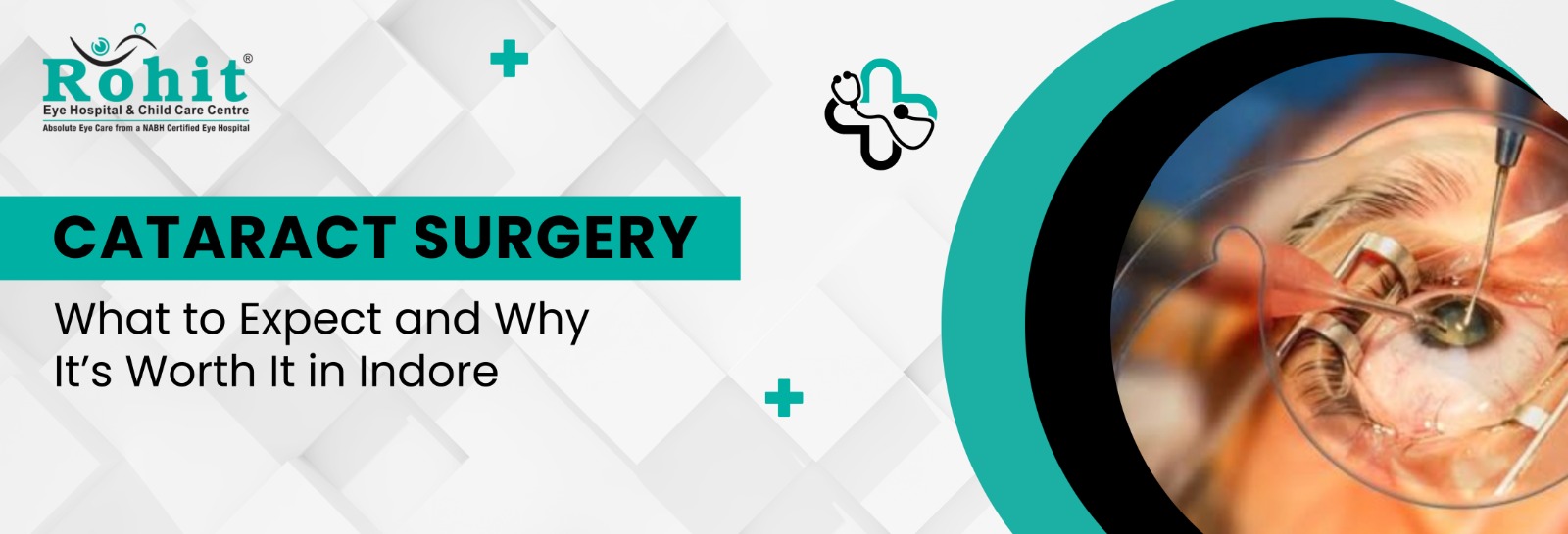 cataract surgery